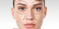 جراحی زیبایی صورت؛ انواع و نحوه انجام