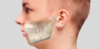 جراحی فک و صورت در درمان بیماری های مختلف